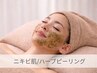 【ニキビ肌改善】頑固な肌荒れ跡、大人のニキビケアに◎（剥離なし）