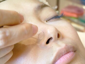 エム アマーレ(M-amare)/キッシング