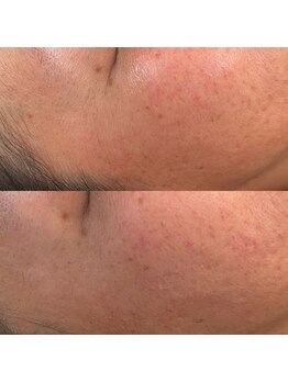 ベリーベリー 九条店(VERY-VERY)/