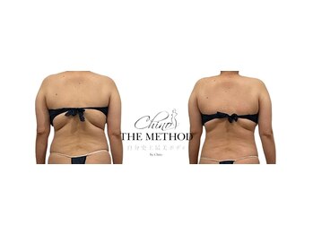 メリア(Mellia)/メンテナンスメソッド