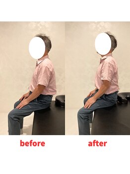 ナオル整体 福岡香椎院(NAORU整体)/60代男性施術事例【首肩こり】