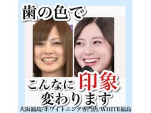 ホワイトニングサロン ホワイト(WHITE)/セルフホワイトニング/大阪/福島