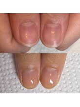 ウェルズユキ(well's yuki)/綺麗な縦長の爪になりたい