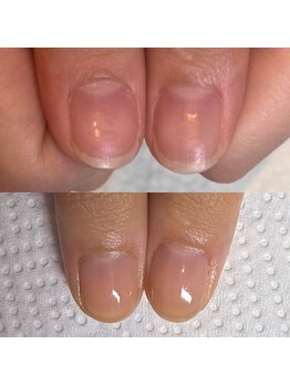 ウェルズユキ(well's yuki)/綺麗な縦長の爪になりたい