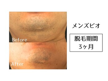 メンズビオ 神戸三宮店/