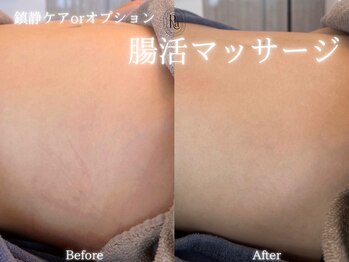 アールエーサロン 恵比寿 広尾(Ra salon)/腸活マッサージ