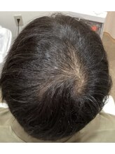 エルプラス(L+)/30代男性.２