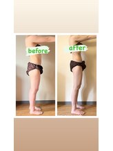 ヨサパーク ルゥー 長津田南口店(Yosapark Luu)/ビフォーアフター