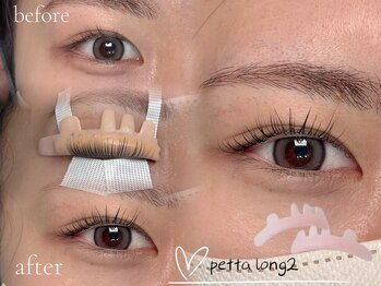 ジョリー(Jolie)/【粘膜が見えやすい方へ】