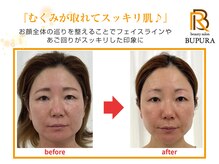 ブプラ つくば店(BUPURA)/before→after　６