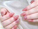 定額/フィルイン/パラジェル