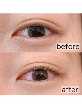 ギャラクシービューティー(galaxy beauty)/アディクトカール