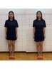 【Ｏ脚/がに股】集中改善！見た目で変化がわかる*国家資格者の本格矯正*