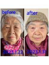 ノウ(nou)/小顔矯正／ヘッドスパ