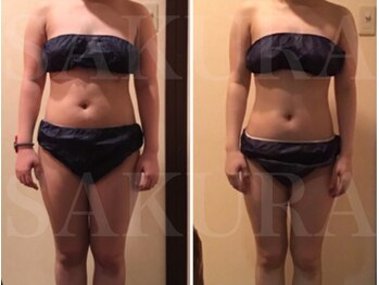 エステティックサロン サクラ(SAKURA)/☆セル,皮下,内臓脂肪を燃焼！