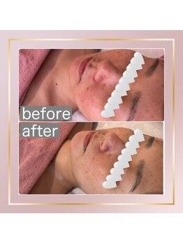 ベルメール(Bellemer)/UNSTRESSアンストレス