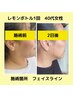 【レモンボトル】回数券のお客様