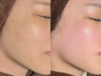 ルーナジェーナ(Luna llena)/池袋　エステ　ルーナジェーナ