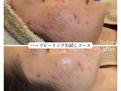 ワイシーハッチ(yc.hacci)の写真