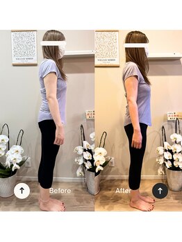 リマ(LIMA)/見た目の変化も実感できます