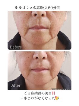 ヨサパーク ミミ 高野店(YOSA PARK mimi)/ビフォーアフター