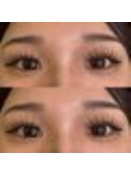 バニーアイズ 天神(Bunny eyes TENJIN)/フラット140