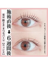 ウィンク 勝どき(wink)/まつげパーマ（ラッシュリフト）