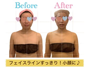 ルフレ(Rufure)/劇的ビフォーアフター♪