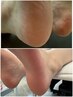 【神フットケア】角質ケア＋パラフィンパック付き　通常5,500→4,000円