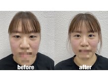 ヒナサク 川崎 八丁畷(hinasaku)の雰囲気（1回で驚きの変化!無理に押したりしないので快適に受けられます◎）