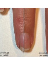 ココデネイル(cocode nail)/爪の形が気になる…