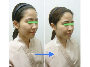 薬手名家 福岡天神店/