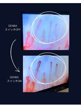 アロナ(ARONA)/DENBA