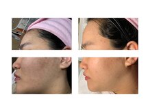 バイオラックスビューティー 大塚店(BIOLUXE BEAUTY)の雰囲気（白を基調にした高級感ある店内☆最新フェイシャル・ニキビケア◎）