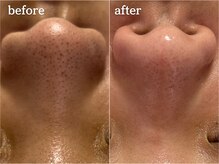 メルシア(merucia)/