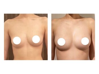 スマイルクルー(SmileClue)/ビフォーアフター症例