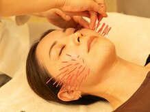 皇漢堂鍼灸療院/オーダーメイド美容鍼