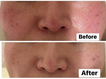 アロマセラピーサロン クオーレ(Cuore)/ゴマージュ×モデリングマスク