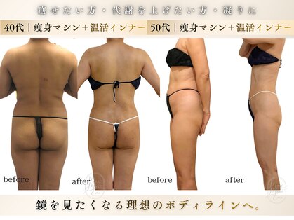 マノマノ エミュー(manomano emu)の写真