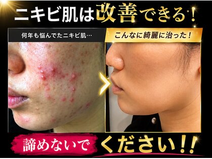 ウィズサロン 天神店(withサロン)の写真
