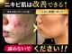 ウィズサロン 天神店(withサロン)の写真