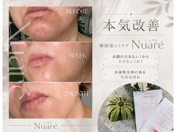 エリア(area.)の写真/【韓国発シミケア肌管理】長年の大きなシミ・お身体にある色沈に★本気改善ケア Nuare
