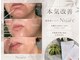 エリア(area.)の写真/【韓国発シミケア肌管理】長年の大きなシミ・お身体にある色沈に★本気改善ケア Nuare
