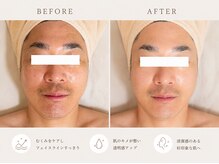 ソワンドゥー(Soin doux)の雰囲気（メンズにも大人気！小顔へ導く本格施術で魅力的な印象へ/毛穴）