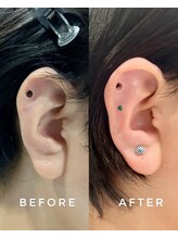 シロ(silo.)/ヒーリングケアクーポン