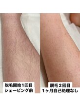 チュベルフェ(tu belle fe)/男子中高生応援脱毛！