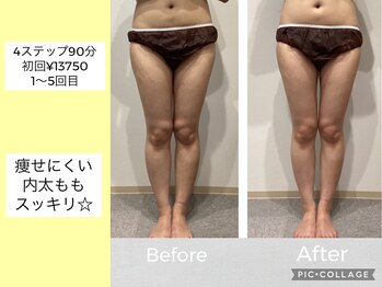 ハピネス(HAPPINESS)/脚　4ステップ90分　1～5回