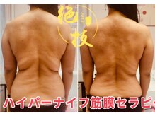 楽だの雰囲気（最強［ハイパーナイフxシェイプ痩身]筋膜リリース＆疲れの解消に）