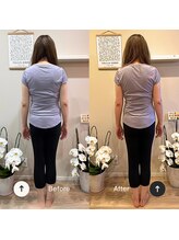 リマ(LIMA)/見た目の変化も実感できます