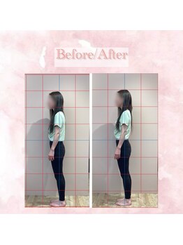 ラ ピラティス 溝の口店(La pilates)/猫背、巻き肩改善 Before/After